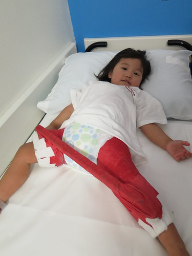 Dani waiting to have her cast removed.