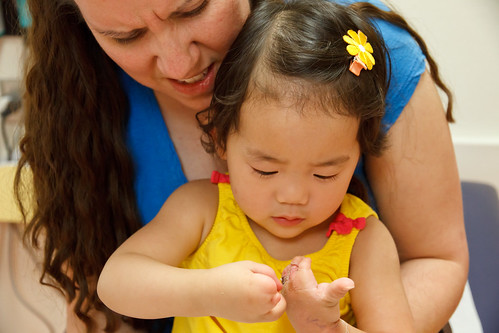 Amelie's Cast comes off